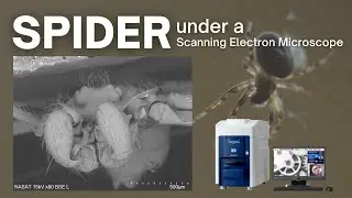Spider under the Microscope (SEM) | Uncut
