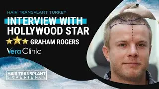 #hairtransplantturkey Interview with Hollywood Star Graham Rogers  #hairtransplant #veraclinic