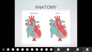 ccTGA anatomy, physiology, embryology by Dr Bernadette Khodaghalian