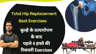 Total Hip Replacement Exercises In Hindi | THR Exercises Week 0-4 | Exercises after Hip Replacement