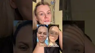 Капсула с пребиотиками для твоей сияющей кожи💊 Артикул WB (копируй с буквами WW)👇#WW217432 РП