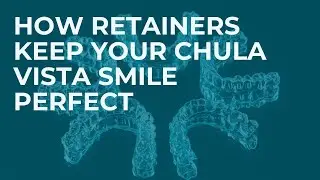How Retainers Keep Your Chula Vista Smile Perfect
