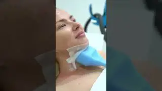 CRISTAL FAT FREEZING DOUBLE CHIN
