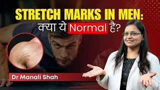 Why do men get stretch marks? | Clear Skin Pune - Dr. Manali Shah