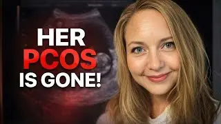 Foods To Eat vs Foods to Avoid For PCOS | Dr Anthony Chaffee
