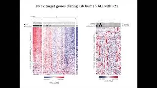 Histone H3K27 Demethylases as a Therapeutic Target in Polysomy 21 Leukemia