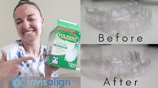 INVISALIGN UPDATE: Tips and Tricks for Clean Trays, No Stains or Smelly Trays!! + DEMO!