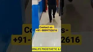 Comfort walk with below knee Carbon Prosthetic leg