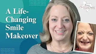 An Ultimate Smile Transformation