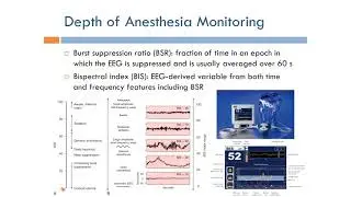 Anesthesia: Depth of Anesthesia Monitoring (English Narration)