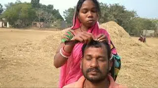 Remove Dandruff by female / Hair caring video /Nitpicking video