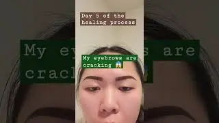 Ombre powder brows healing process day 5! #ombrepowderbrows #healingprocess