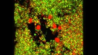 3D movie of human leukocytes embedded in Staphylococcus aureus biofilm grown under fluid flow