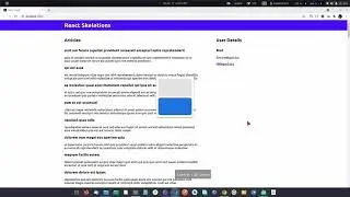 React Js - Skeleton Loading Screen with using API