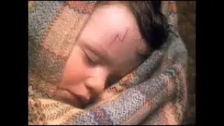 Why Harry's scar is lightning bolt ⚡