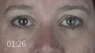 Real Results with Nerium Age Defying Eye Serum