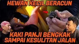 KAKI PANJI BENGKAK KETUSUK BULU BABI SAAT CARI KERANG BAKAU DI PULAU MALAHING KALIMANTAN TIMUR