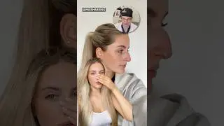 Incredible Nose Job Transformation- Surgeon Reacts