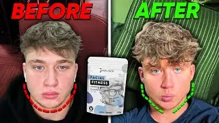 Does Training Your Jaw ACTUALLY WORK (The Truth)