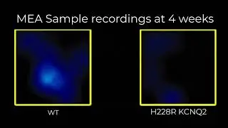 Multi-electrode Array recordings of spontaneous activity of iXCells  Glutamatergic Neurons