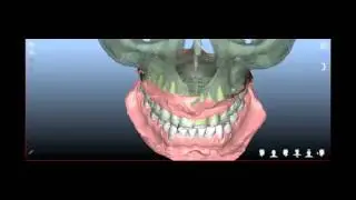 NemoCeph 3D