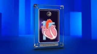 Isolated systolic hypertension