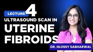 Lecture 4 | Ultrasound Scan in Uterine Fibroids by Dr. Glossy | Iqramed Academy