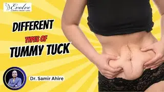 Different Types of Tummy Tuck Surgery | Dr. Samir Ahire | Evolve Cosmetic Clinic