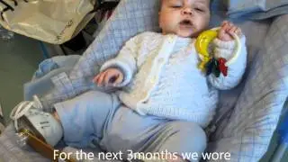 Our Talipes Story - Daniel de Kock