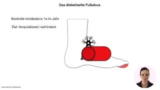 Wundversorgung in der Pflege: diabetisches Fu&szlig;ulcus, Ulcus cruris & Dekubitus www.clipdocs.de
