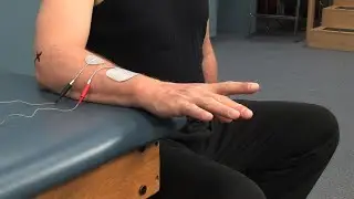 Electrode Placement for Finger Extension Muscle Stimulation