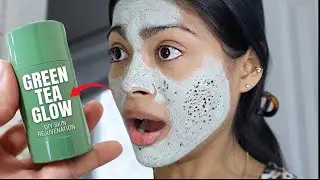 DIY green tea face mask | best acne treatments