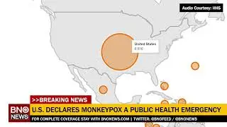 LIVE: U.S. health officials provide update on monkeypox outbreak