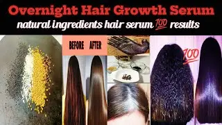 Hair regrowth serum remedy by Billokadhaaba ||extreme hair growth challenge with natural ingredients
