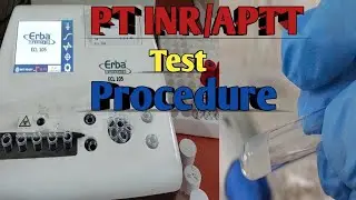PT INR Test Procedure | Prothrombin Time | PT /APTT Blood Test Procedure |