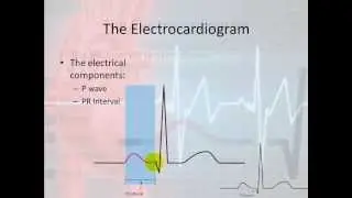 Basic Electrophysiology, part 4 - The Bumps and Squiggles