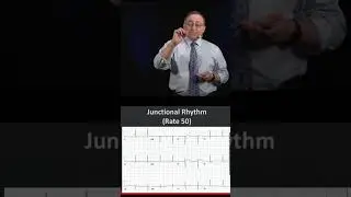 Junctional Rhythm Example ❤️📈 #shorts