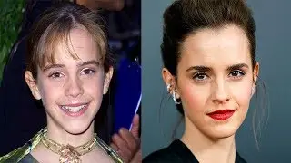Face Transformation Emma Watson ( how changed ) | Трансформация Эмма Уотсон ( как менялась )