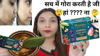 #Himalaya Ayurveda clear skin soap #Honest review by Deepaksshi.
