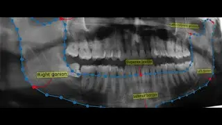 Applying Deep Learning to biomedical image analysis
