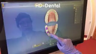 Digital impression Sirona apollo DI #Zahnarztungarn#zahnpraxisungarn
