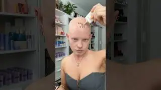 I don&rsquo;t wear wigs for having Alopecia&hellip;