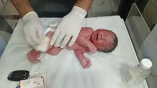 Newborn Care in Labor Room | First Care, Inj K-Lot & Initial Assessment