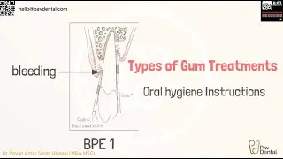 Informed Consent - Oral Hygiene Instruction - Gum Treatment Part 2/3