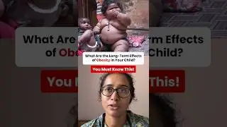 Long-Term Effects of Childhood Obesity Every Parent Must Know