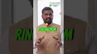 Curing Ringworm With Neem & Curd: Quick Results! #dr #drrobin #health #ayurvedicdetox  #ayurevda