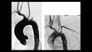 INTERVENTION AND VASCULAR RADIOLOGY CASES-PART 1-DR. AMR SAADAWY