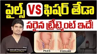 Piles vs Fissure in Telugu | Right Diagnosis & Best Treatment | Treatment Range Hospital