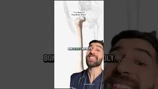 How You Protect Your Bones? Doctor Explains.