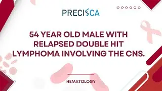 Expert Cancer Panel: Relapsed double-hit lymphoma involving the CNS